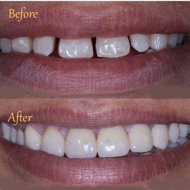 smile designing in chengannur