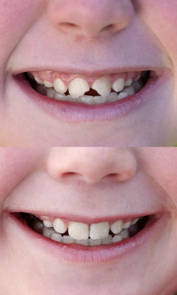 smile designing in chengannur